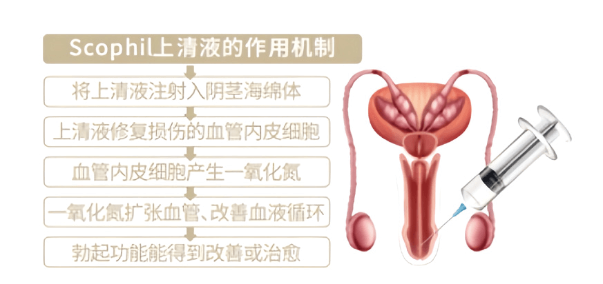 ED(勃起功能障碍)治疗