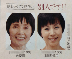 AGA 脱发治疗